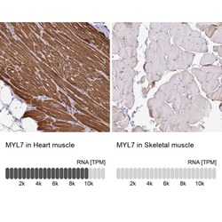 MYL7 Antibody, Novus Biologicals 25 &mu;L; Unlabeled:Antibodies, Polyclonal